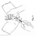 Fig. 08 - Transobturator surgical articles and methods
