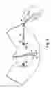 Fig. 09 - Transobturator surgical articles and methods