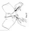Fig. 26 - Transobturator surgical articles and methods