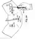 Fig. 27 - Transobturator surgical articles and methods