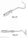 Fig. 31 - Transobturator surgical articles and methods