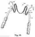Fig. 34 - Transobturator surgical articles and methods