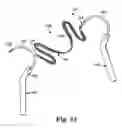 Fig. 35 - Transobturator surgical articles and methods
