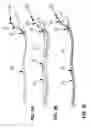 Fig. 04 - Method and device for covering a medical instrument