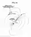 Fig. 15 - System for detecting position of capsule endoscope in subject