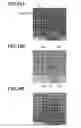 Fig. 11 - Ultrasonic image processing apparatus, ultrasonic image processing method and ultrasonic image processing program