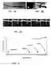 Fig. 03 - Scanning probe using MEMS micromotor for endosocopic imaging