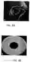 Fig. 04 - Scanning probe using MEMS micromotor for endosocopic imaging