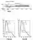 Fig. 04 - Method and an apparatus for pulse plethysmograph based detection of nociception during anesthesia or sedation