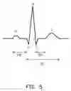 Fig. 06 - Automatic diagnosing method for autonomic nervous system and device thereof