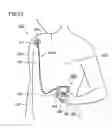 Fig. 14 - Portable electrocardiograph