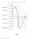 Fig. 06 - Ventilator patient synchronization
