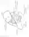 Fig. 14 - Methods and apparatus for securing medical instruments to desired locations in a patient's body