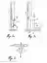 Fig. 04 - Method of calibration for the representation of knee kinematics and harness for use therewith