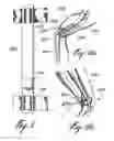 Fig. 09 - Method of calibration for the representation of knee kinematics and harness for use therewith