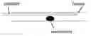 Fig. 01 - Confinement of kidney-stone fragments during lithotripsy