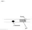Fig. 04 - Confinement of kidney-stone fragments during lithotripsy
