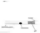 Fig. 05 - Confinement of kidney-stone fragments during lithotripsy