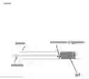 Fig. 07 - Confinement of kidney-stone fragments during lithotripsy