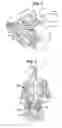 Fig. 02 - Lymphedema treatment system