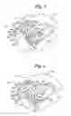 Fig. 04 - Lymphedema treatment system
