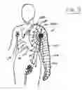 Fig. 07 - Lymphedema treatment system