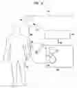 Fig. 03 - Apheresis methods and devices