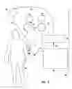 Fig. 06 - Apheresis methods and devices