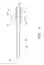 Fig. 05 - Blood treatment catheter and method
