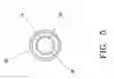 Fig. 06 - Blood treatment catheter and method