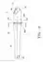 Fig. 10 - Blood treatment catheter and method