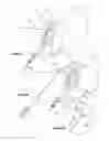 Fig. 13 - Cystotomy catheter capture device and methods of using same