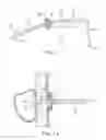 Fig. 02 - Method of assembling a percutaneous gastrostomy device