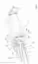 Fig. 03 - Safety syringe