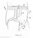 Fig. 06 - Disposable garment with stretchable absorbent assembly