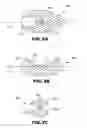 Fig. 04 - Microneedle arrays and methods of manufacturing the same