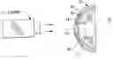 Fig. 01 - Method of treatment of refractive errors using subepithelial or intrastromal corneal inlay with bonding coating
