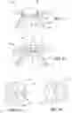 Fig. 16 - Method of treatment of refractive errors using subepithelial or intrastromal corneal inlay with bonding coating