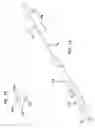 Fig. 12 - Laser-based maze procedure for atrial fibrillation