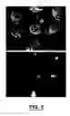 Fig. 03 - Bone treatment instrument and method