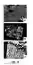 Fig. 15 - Bone treatment instrument and method
