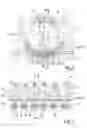 Fig. 02 - System for fixing a part to a bone element