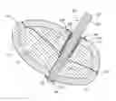 Fig. 01 - Bone fixation system with radially extendable anchor