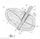Fig. 02 - Bone fixation system with radially extendable anchor