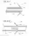 Fig. 10 - Bone fixation system with radially extendable anchor