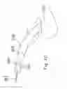 Fig. 20 - Laterally insertable interspinous process implant