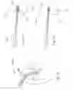 Fig. 23 - Laterally insertable interspinous process implant