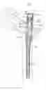 Fig. 01 - Intramedullary nail