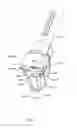 Fig. 07 - Parallel distractor and related methods for use in implanting an artificial intervertebral disc