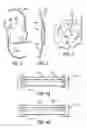 Fig. 02 - Intraocular lens materials suitable for insertion through a small bore cartridge